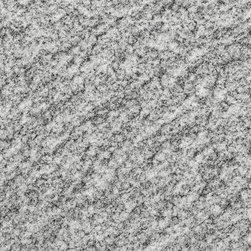 Viscount White — Bush-Hammered — Natural Stone material sample